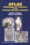 NewAge Atlas: Pathology to Tumours of the Central Nervous System